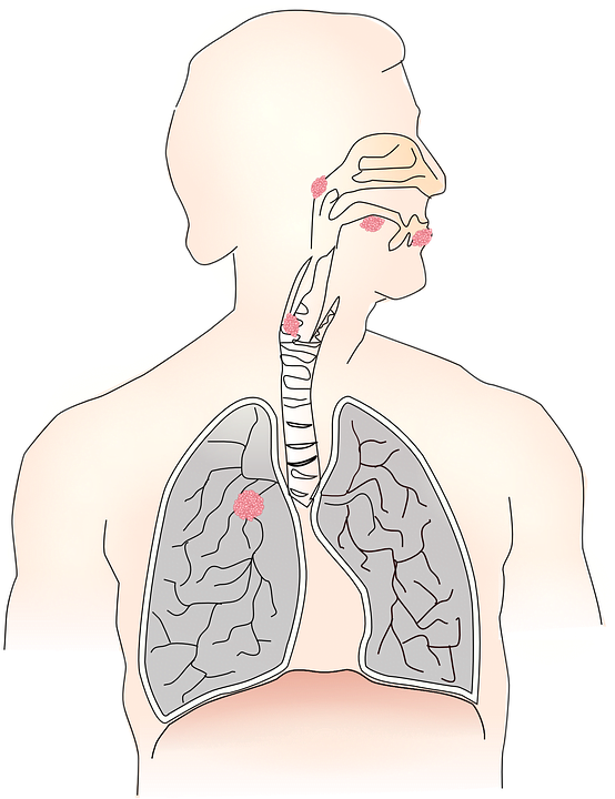 Mesothelioma and Veterans